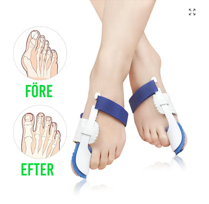 Nattskinne for hallux valgus